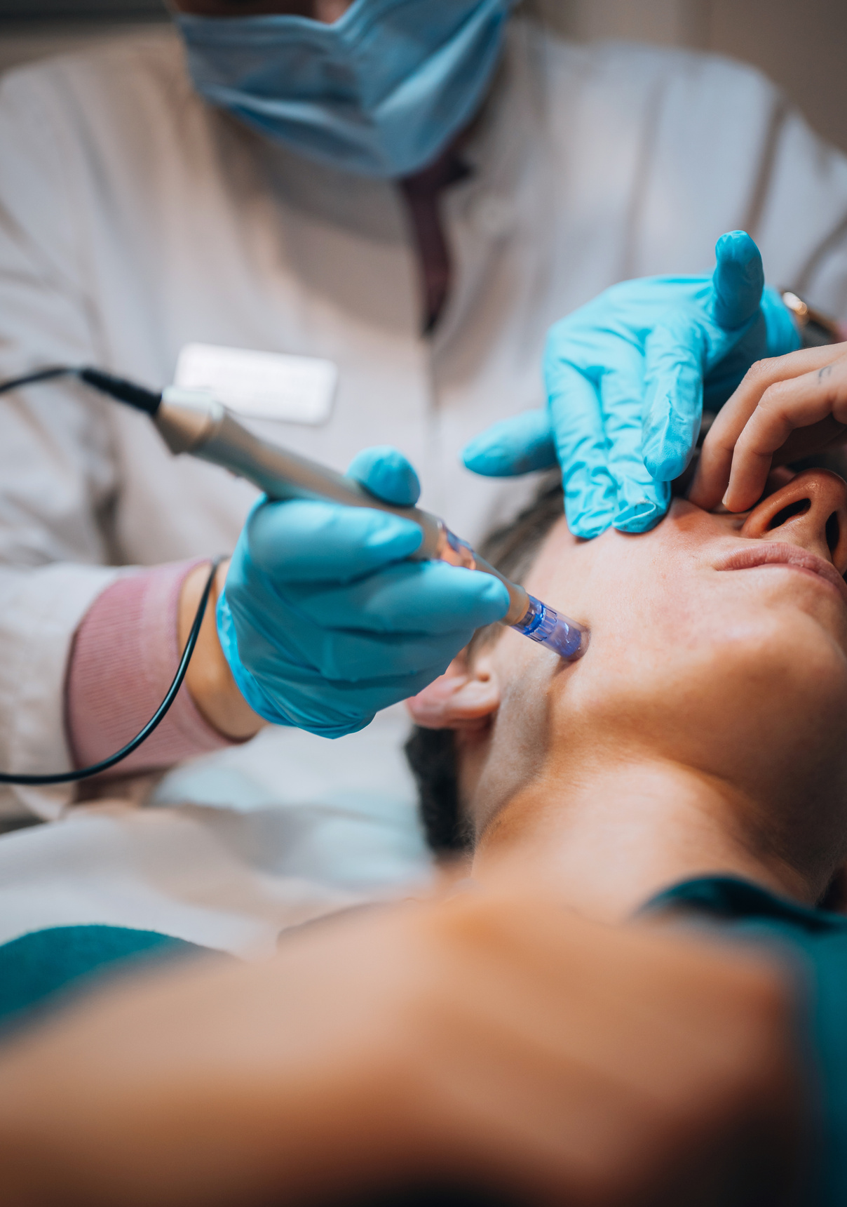 Young Man Having Dermapen Micro-Needling Treatment